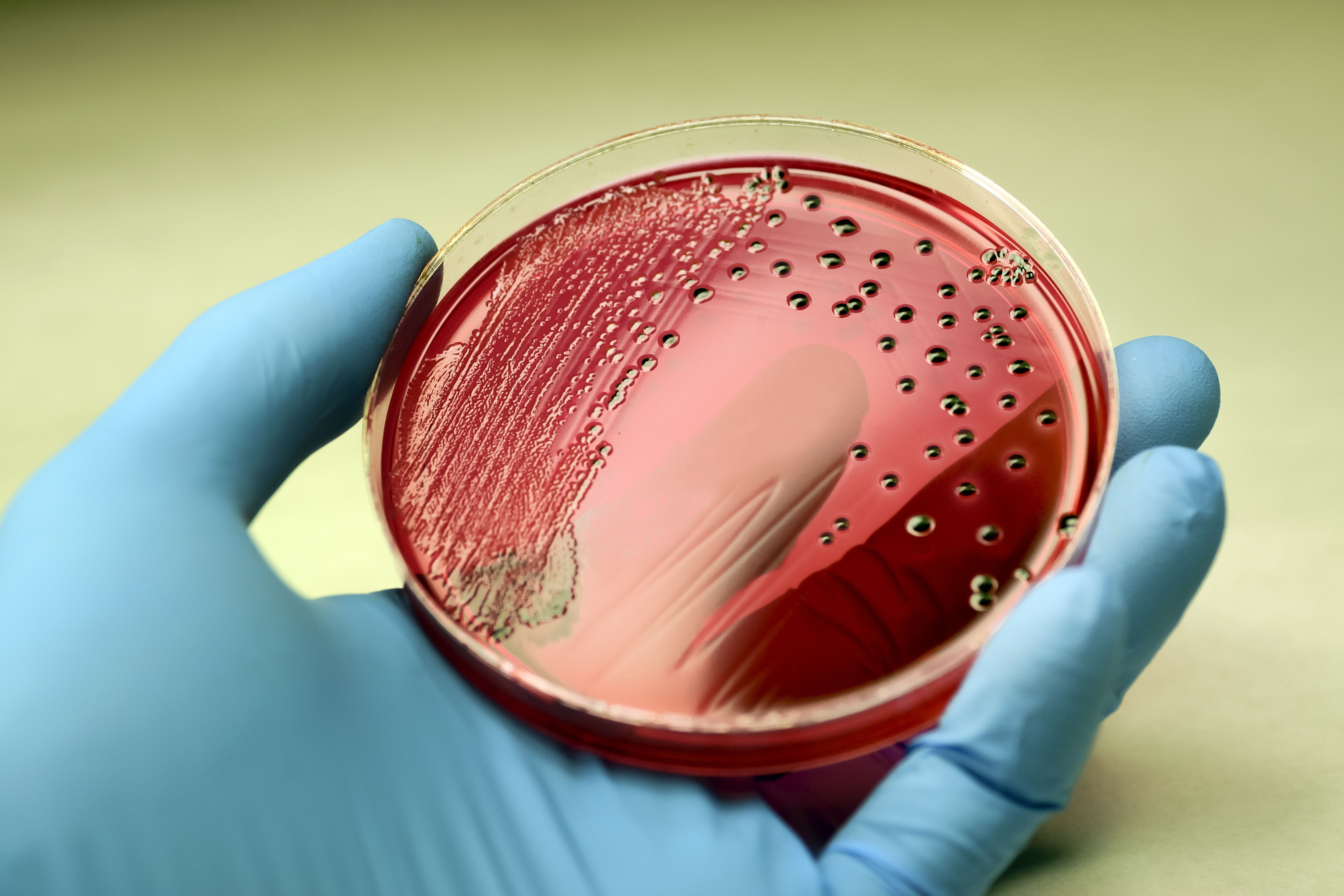 texas-a-m-research-unlocks-mystery-of-salmonella-infection-texas-a-m