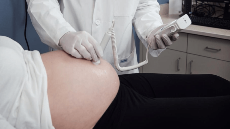 preeclampsia - pregnancy