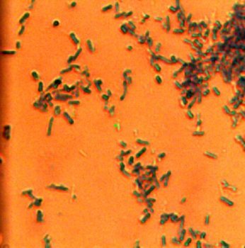 E coli bacteria under an optical microscope