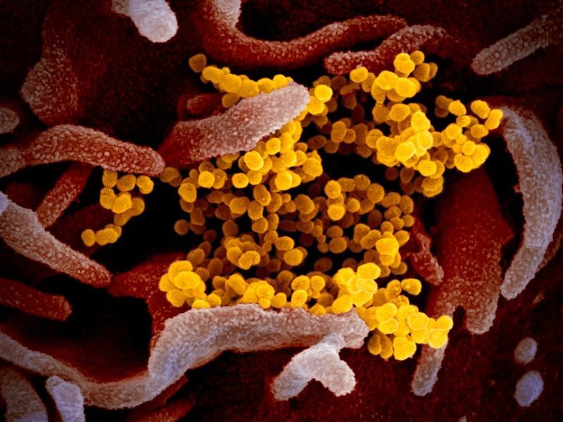 microscope image of SARS-CoV-2
