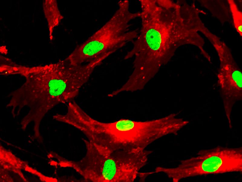 Mesenchymal stem cells labeled with fluorescent molecules