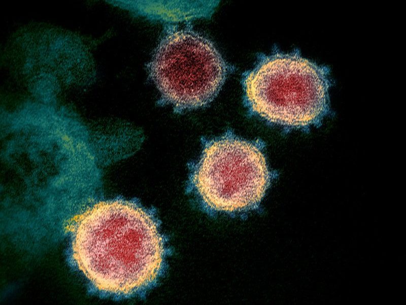 transmission electron microscope image shows SARS-CoV-2—also known as 2019-nCoV, the virus that causes COVID-19—isolated from a patient in the U.S.