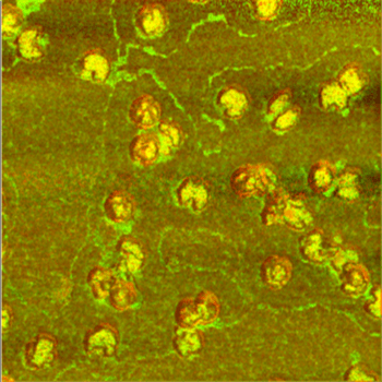 cocmplex composite image of virus particles