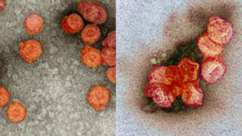 side by side microscopic images of virus suspended in water