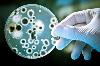 photo of a gloved hand holding up a petri dish filled with bacteria