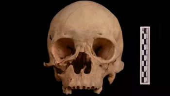 close up photo of a man's skull