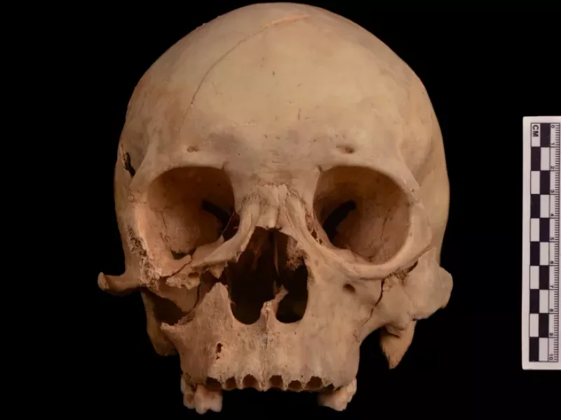close up photo of a man's skull