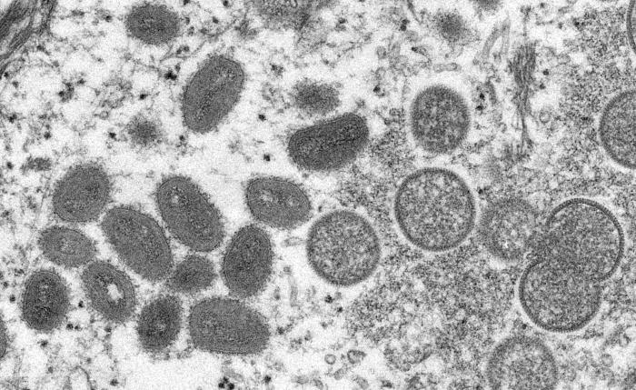 electron microscope image of the virus
