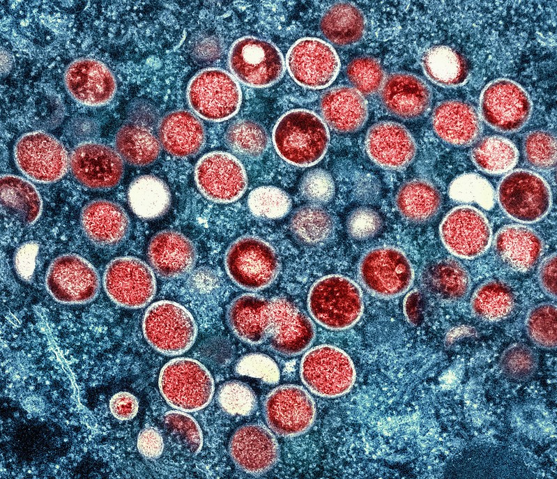 Microscopy images of different particles, with monkeypox particles colored red