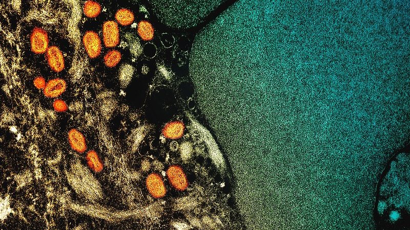 electron micrograph image of monkeypox