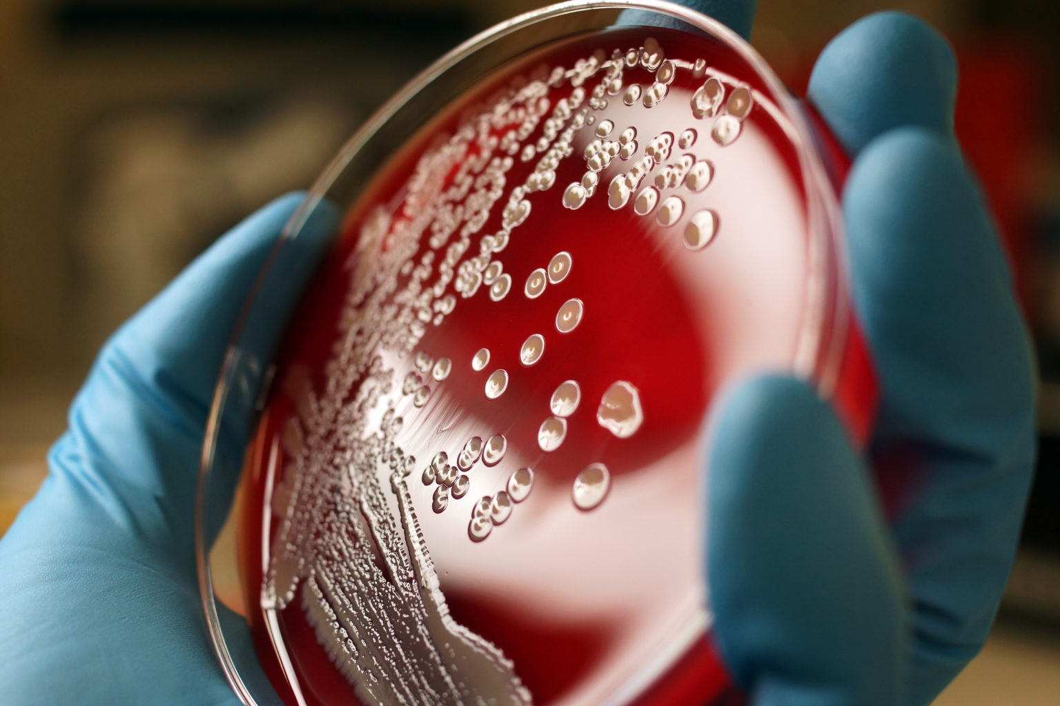 Where Do Antibiotic Resistant Bacteria Come From