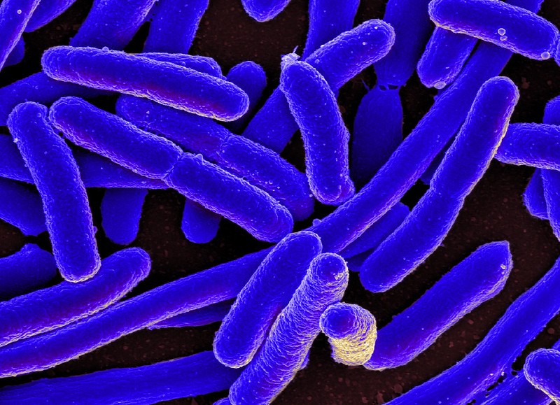 A microscopic image of E coli bacteria