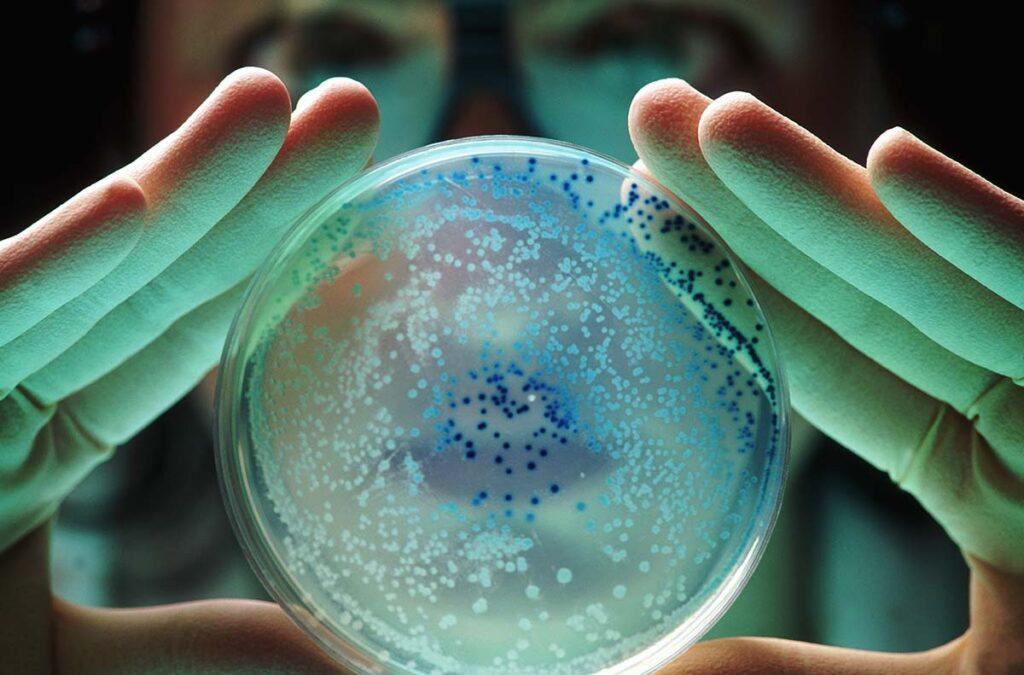 Researcher with E Coli bacteria in a petri dish