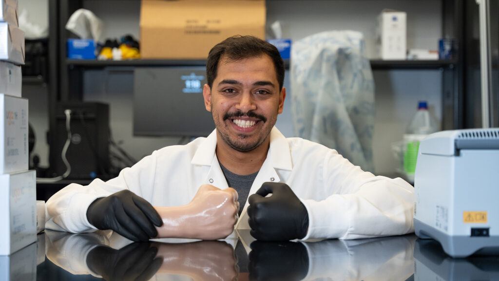 A man in a white lab coat holds a prosthetic hand.