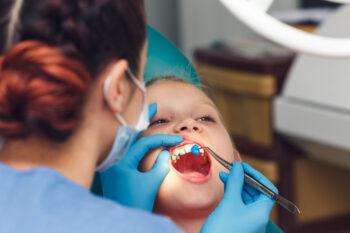 Dentist fluoridates a child's teeth. Strengthening tooth enamel