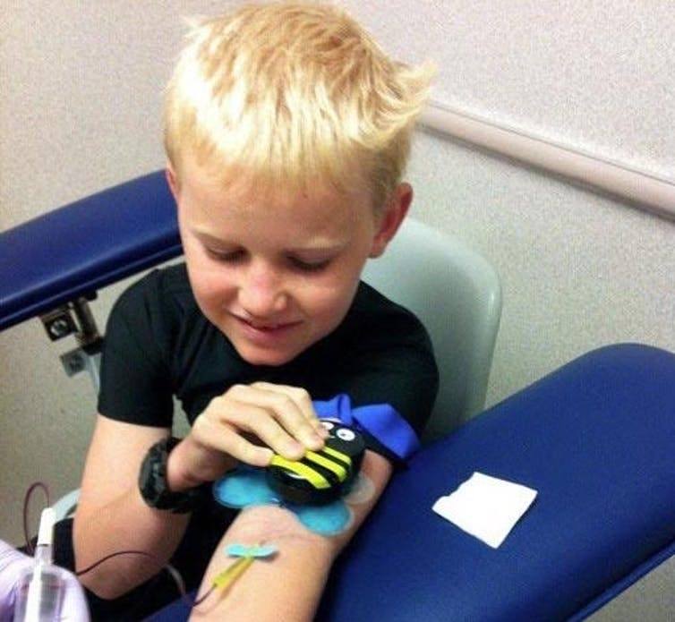 Buzzy Bee, a device which helps lower pain and decrease fear in kids receiving an IV or other injection, is shown on the arm of a boy. (MMJ Labs)