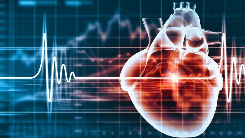 Heart on a Cardiogram